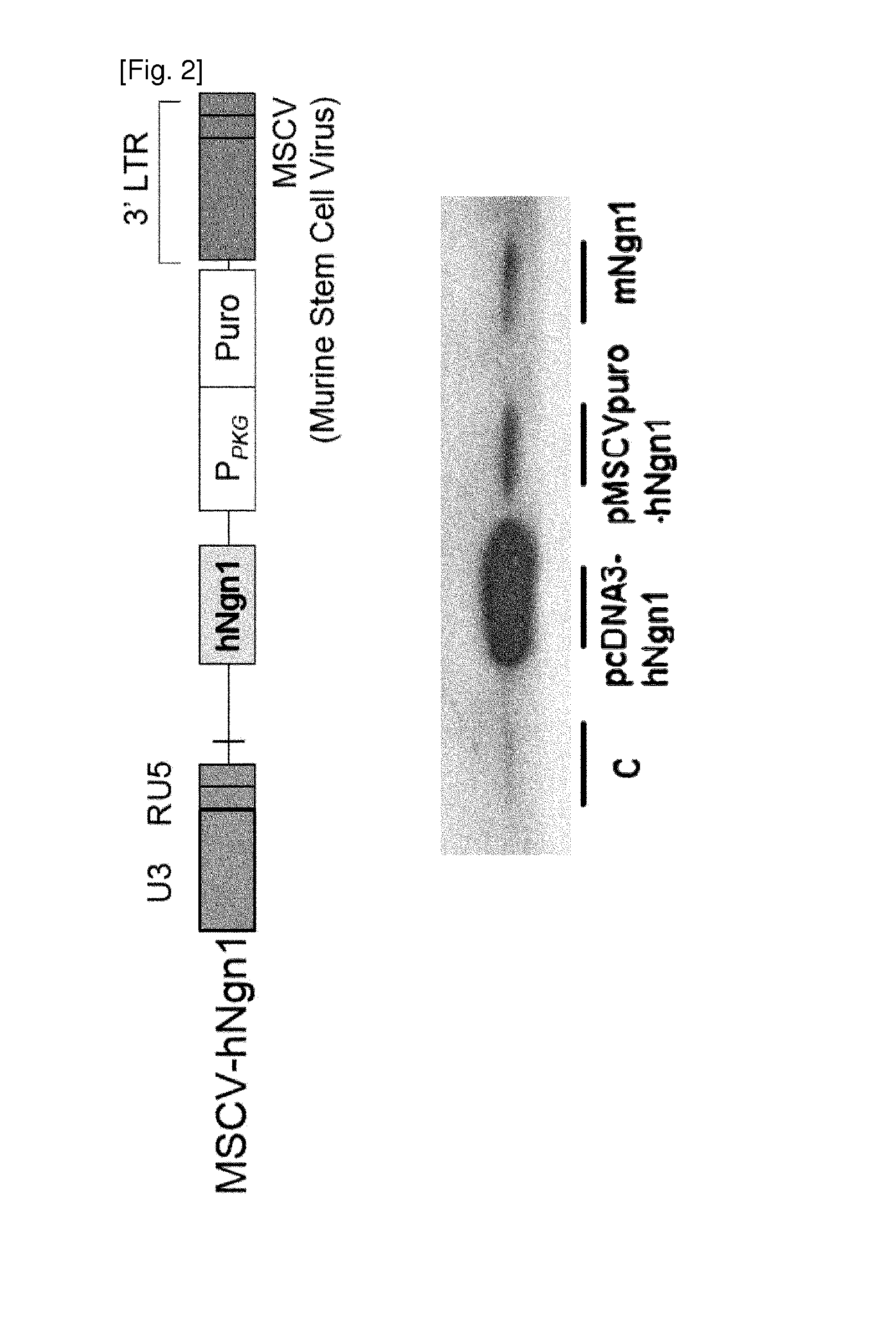 Adult stem cell line introduced with hepatocyte growth factor gene and neurogenic transcription factor gene with basic helix-loop-helix motif and uses thereof