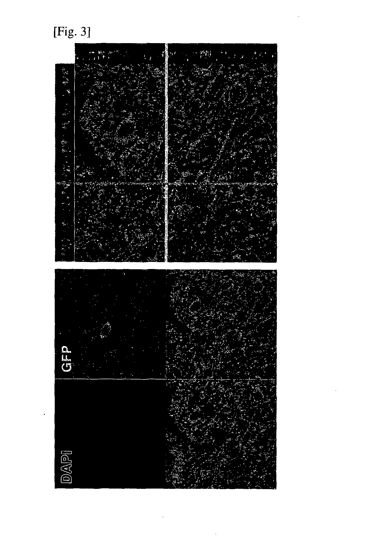 Adult stem cell line introduced with hepatocyte growth factor gene and neurogenic transcription factor gene with basic helix-loop-helix motif and uses thereof