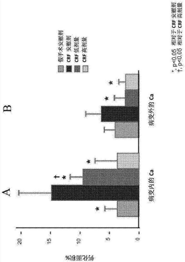 Methods and compositions for reducing or preventing vascular calcification during peritoneal dialysis therapy