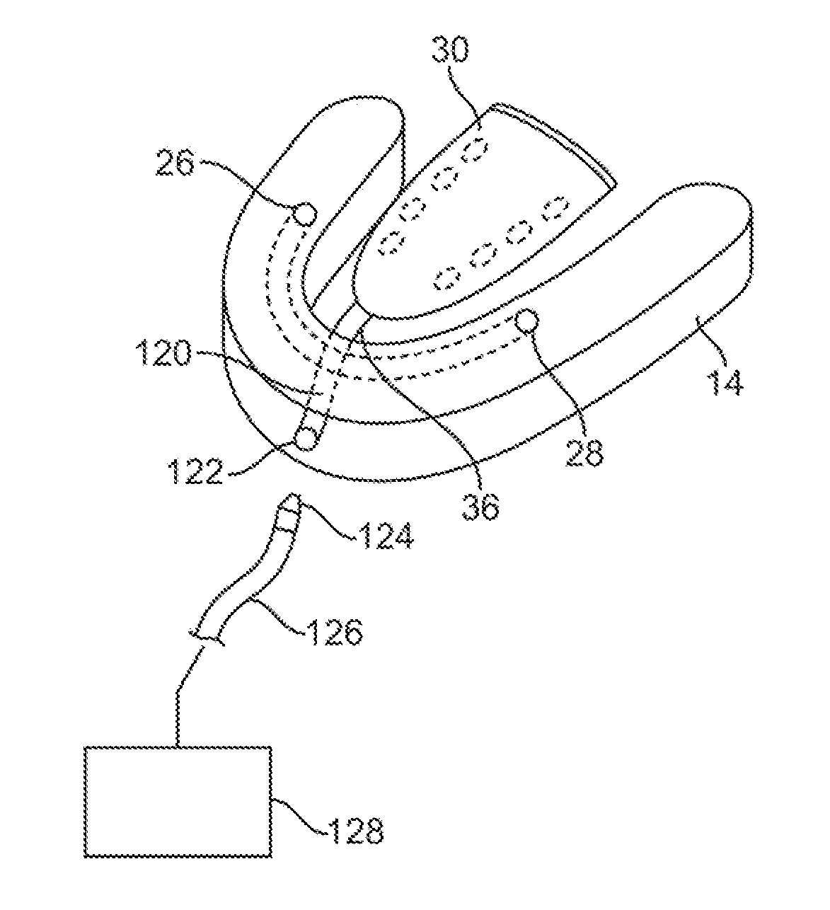 Wearable tissue retention device