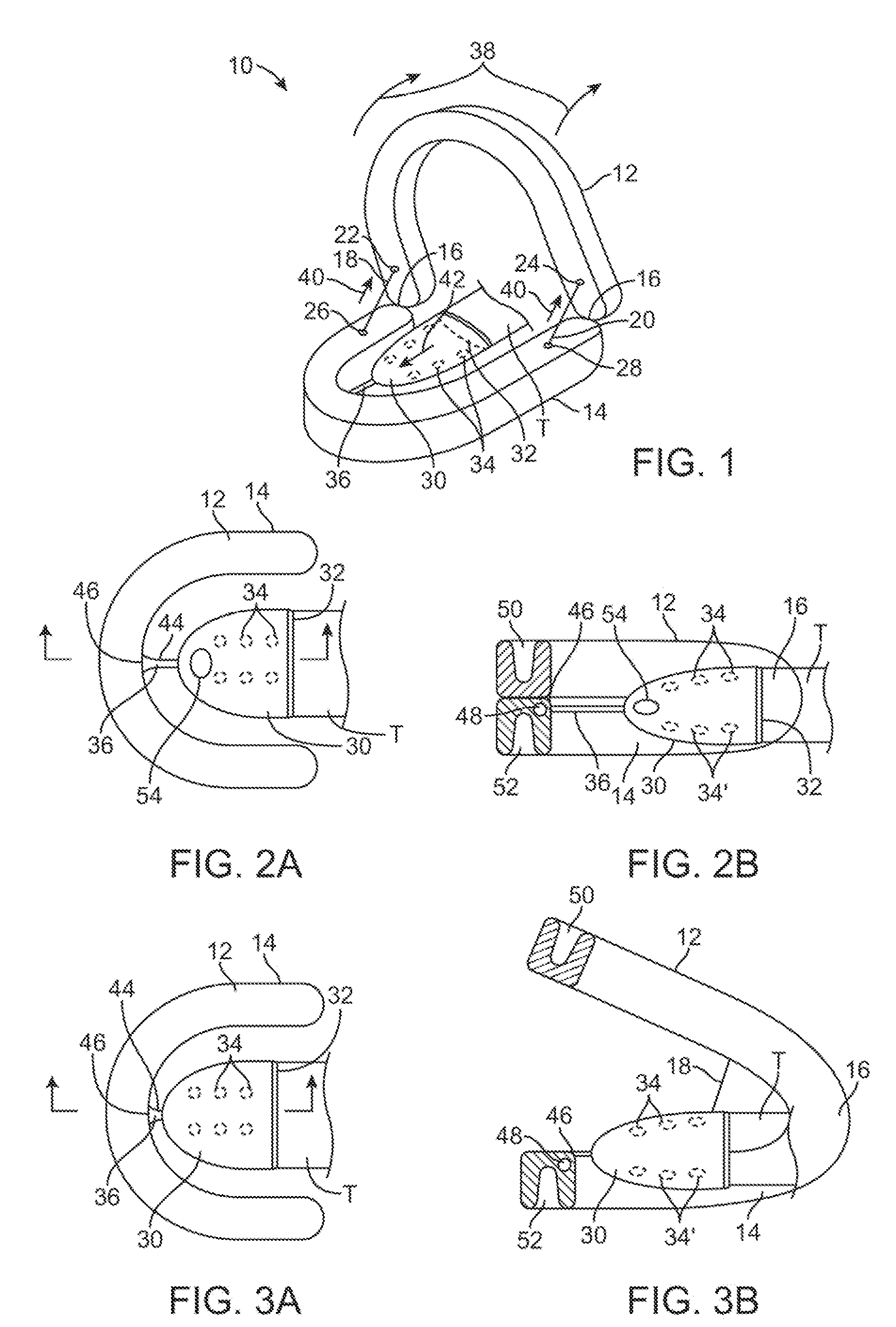 Wearable tissue retention device