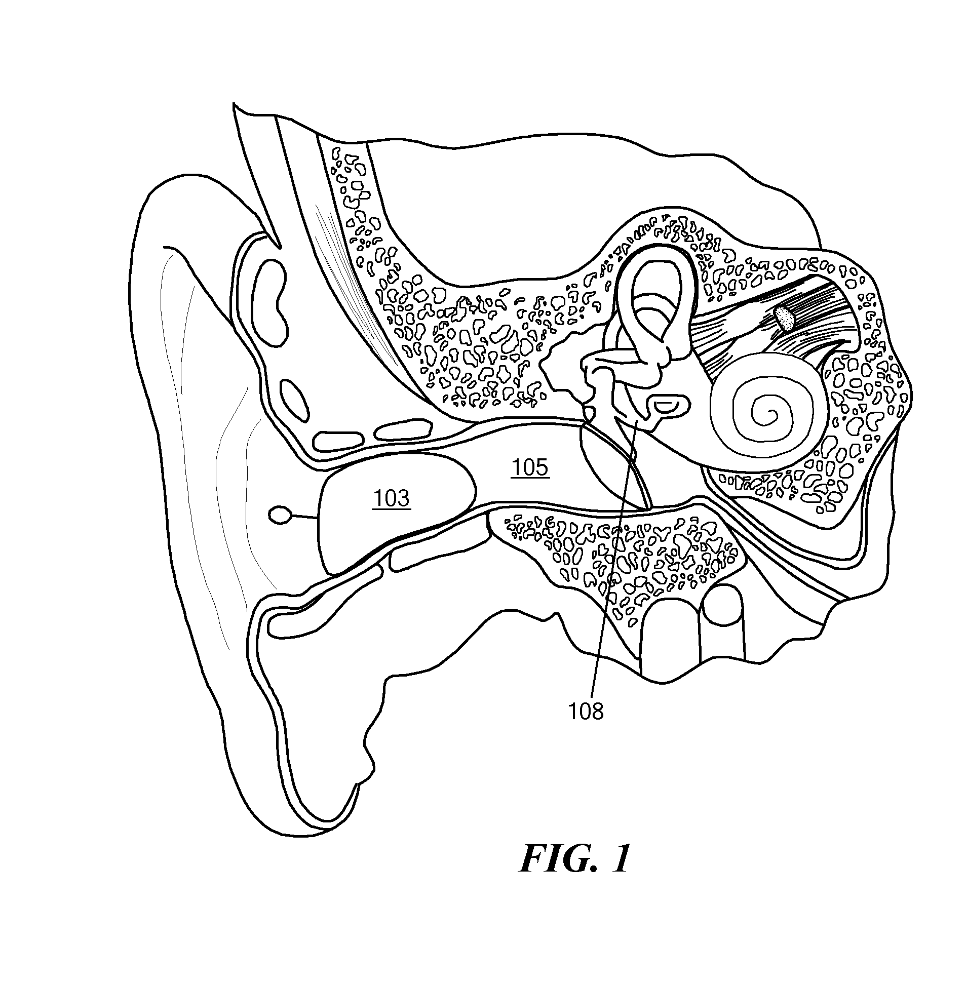 Hearing System