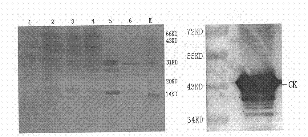 Human creatine kinase single-chain antibody with molecular chaperone function