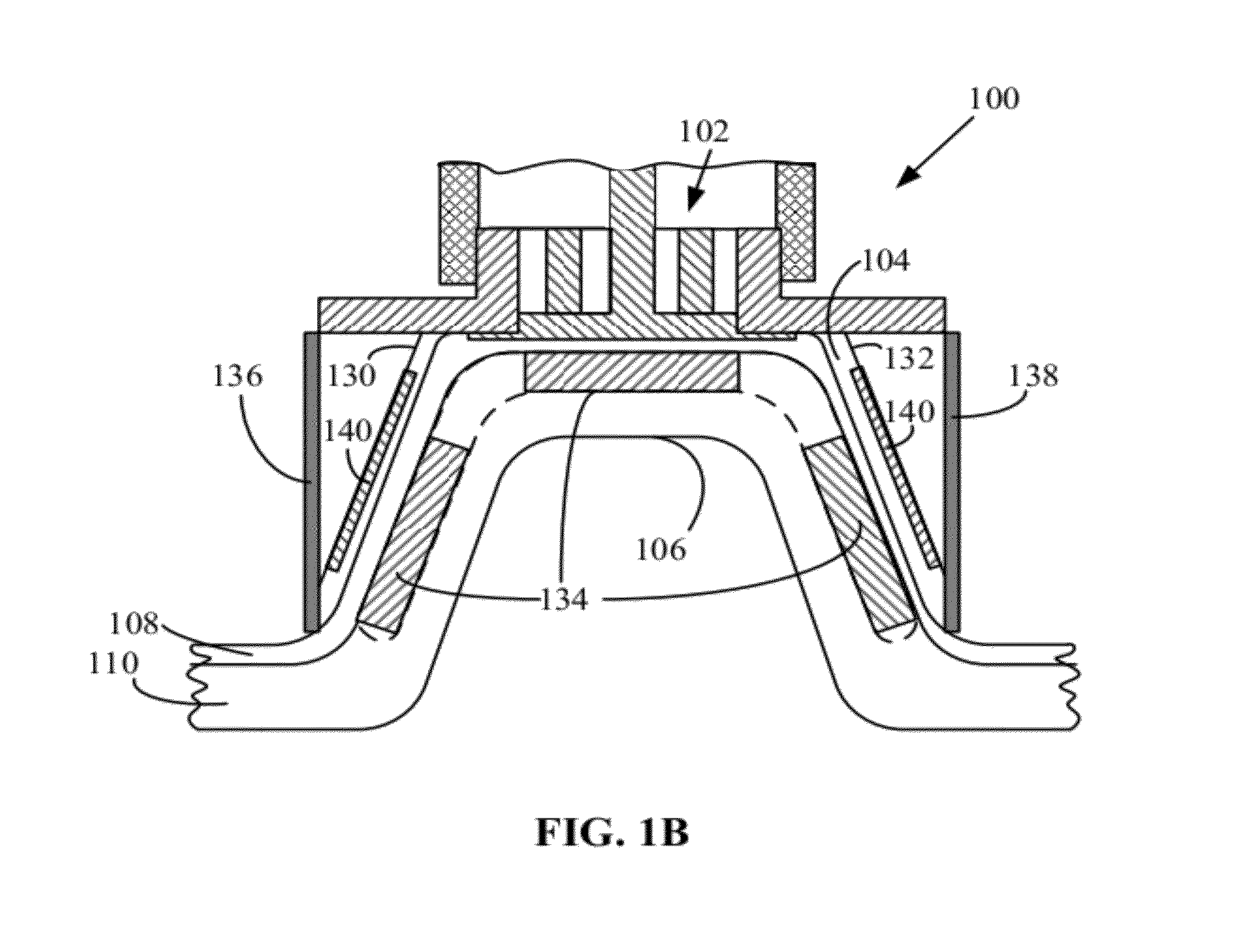 Method and apparatus for real time monitoring of tissue layers