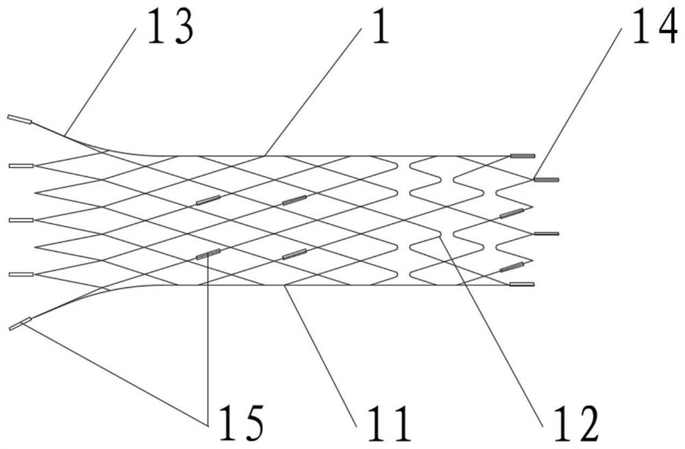 Intracranial aneurysm embolism auxiliary stent and conveying system