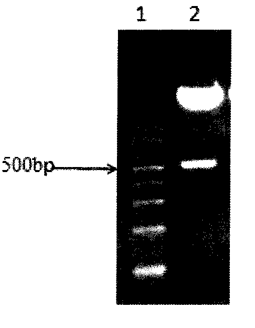 Human IL-15 subtype protein and preparation method and application thereof