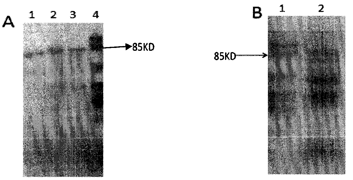 Human IL-15 subtype protein and preparation method and application thereof