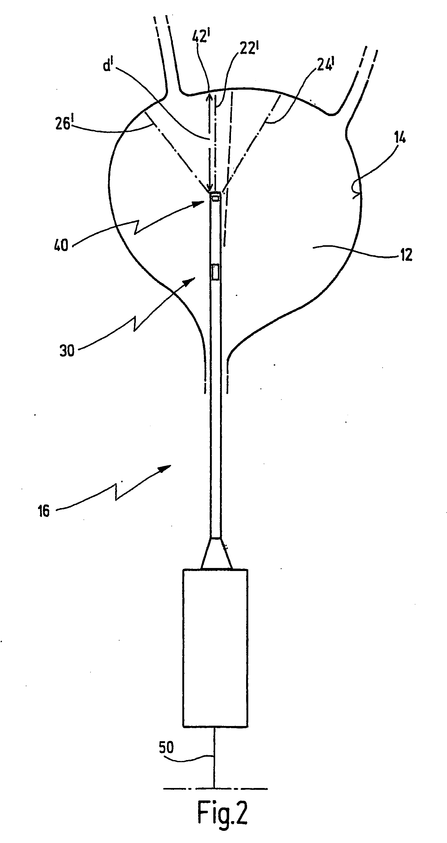 Method and apparatus for generating at least one section of a virtual 3D model of a body interior