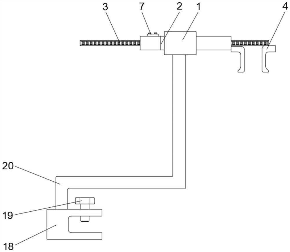 Sternum dilator