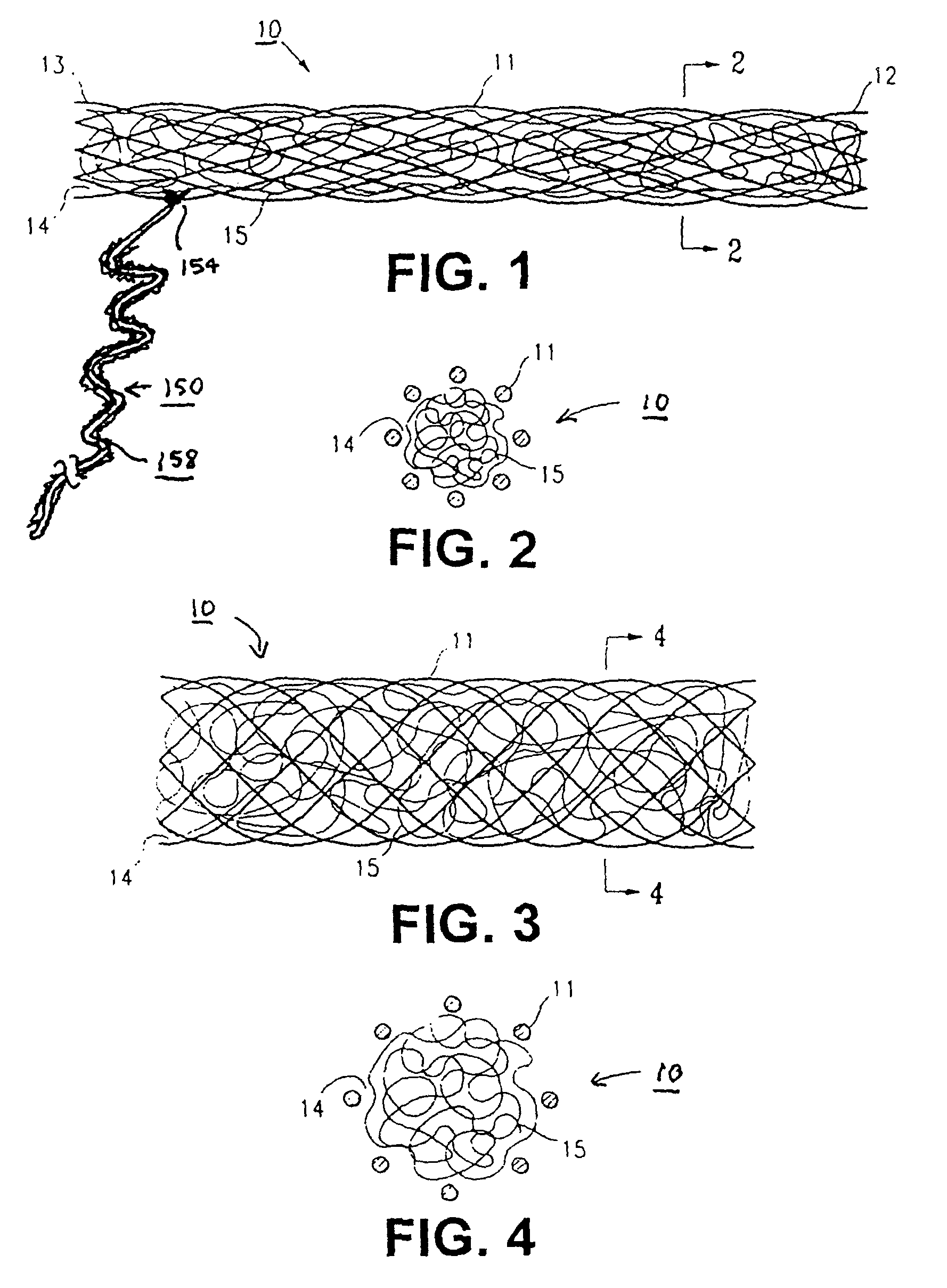Methods and apparatus for occluding reproductive tracts to effect contraception