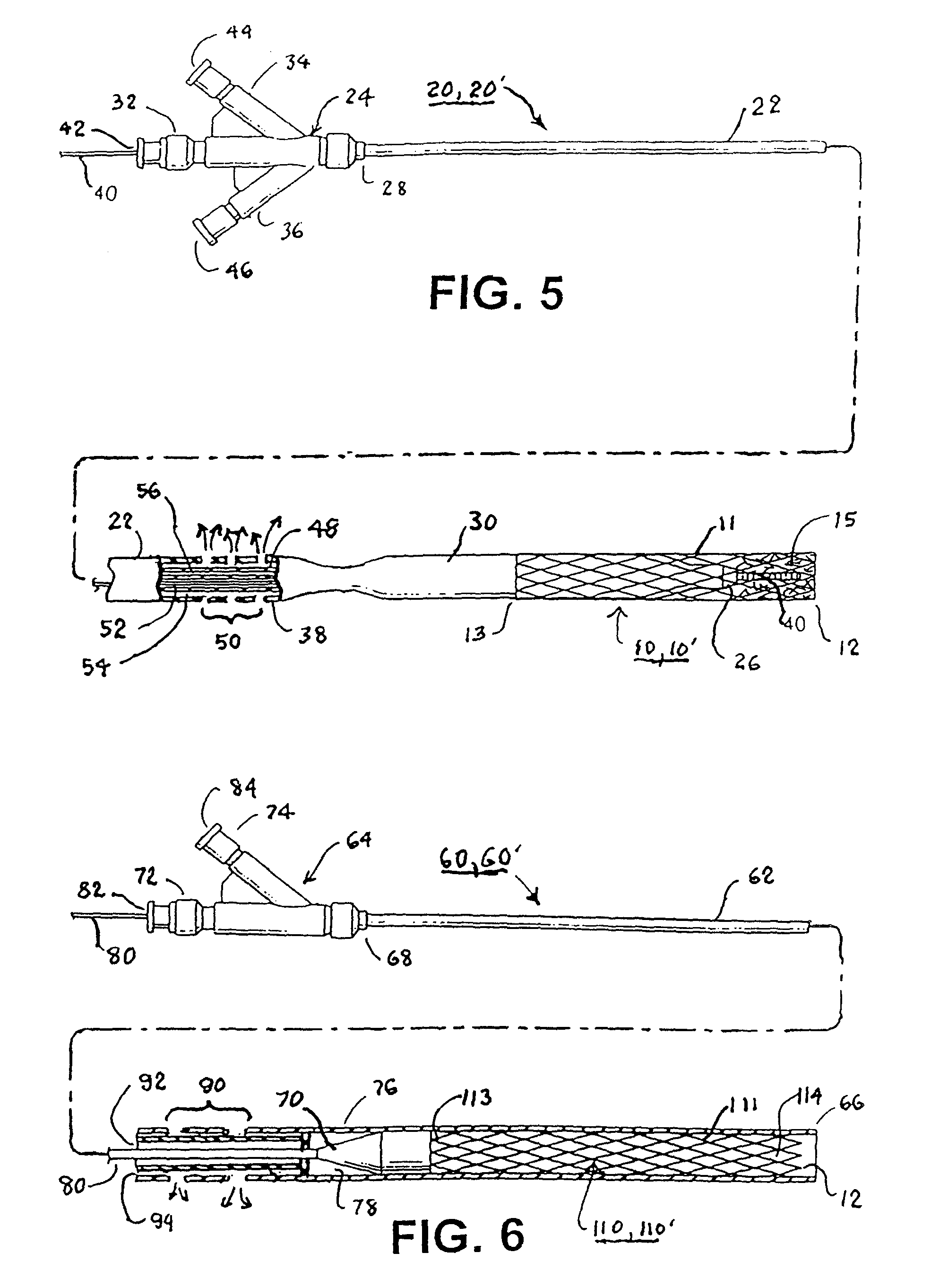 Methods and apparatus for occluding reproductive tracts to effect contraception