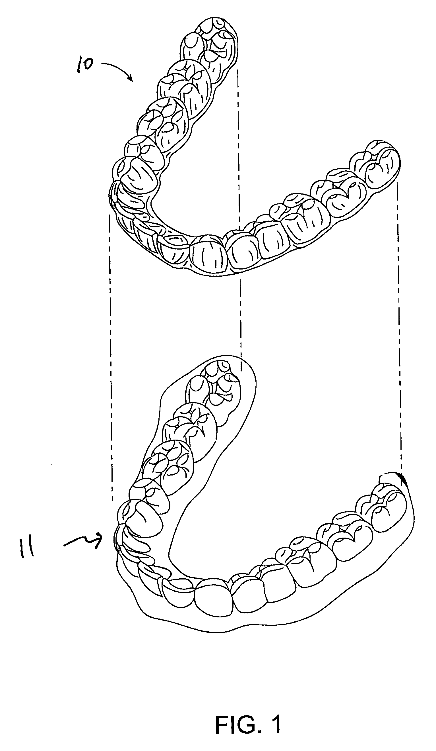 Orthodontic tooth movement device, systems and methods