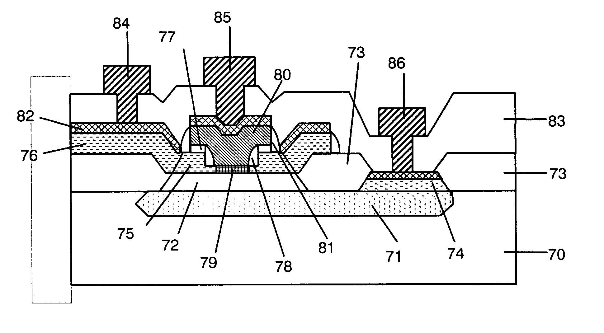 Self-aligned heterojunction bipolar transistor and manufacturing method thereof