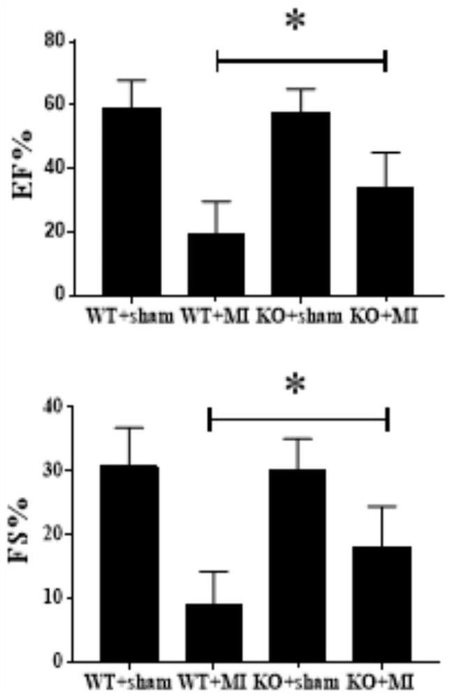 Application of RAB22A gene as target to preparation of myocardial infarction treatment product and related products