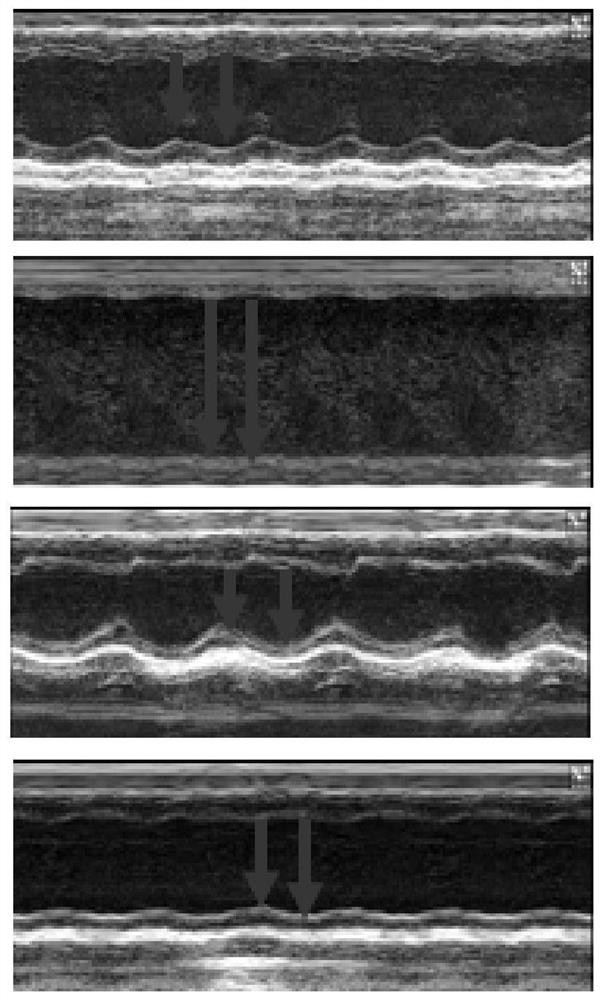 Application of RAB22A gene as target to preparation of myocardial infarction treatment product and related products