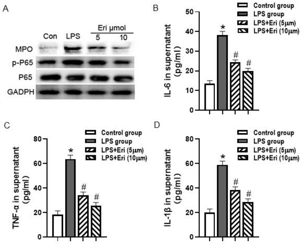 Application of eriocitrin in preparation of LPS-induced sepsis acute lung injury protection medicine