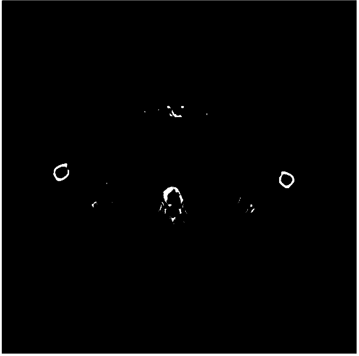 Method for reconstructing sparse degree CT (Computed Tomography) image