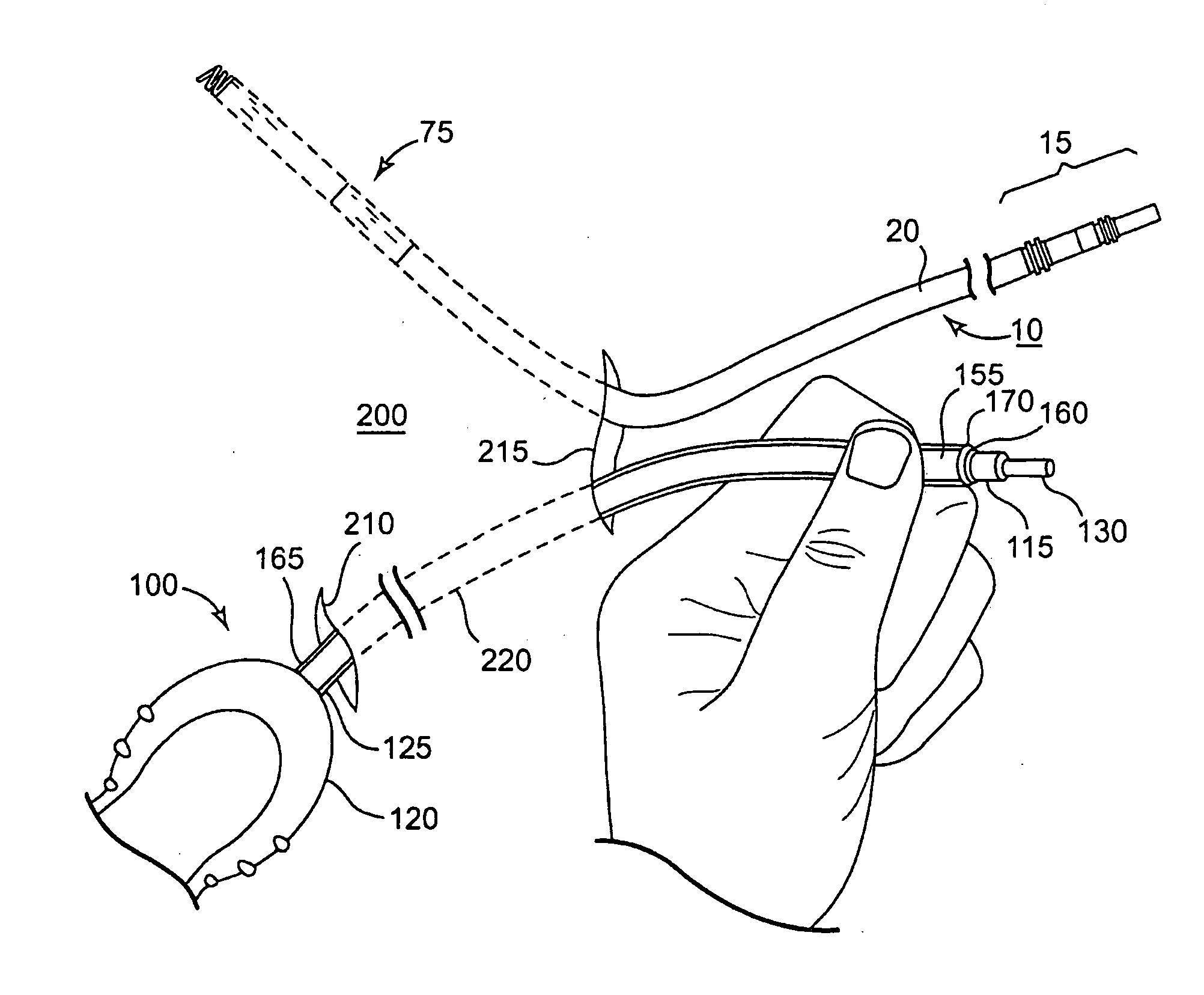 Systems and Methods for Implanting Medical Devices