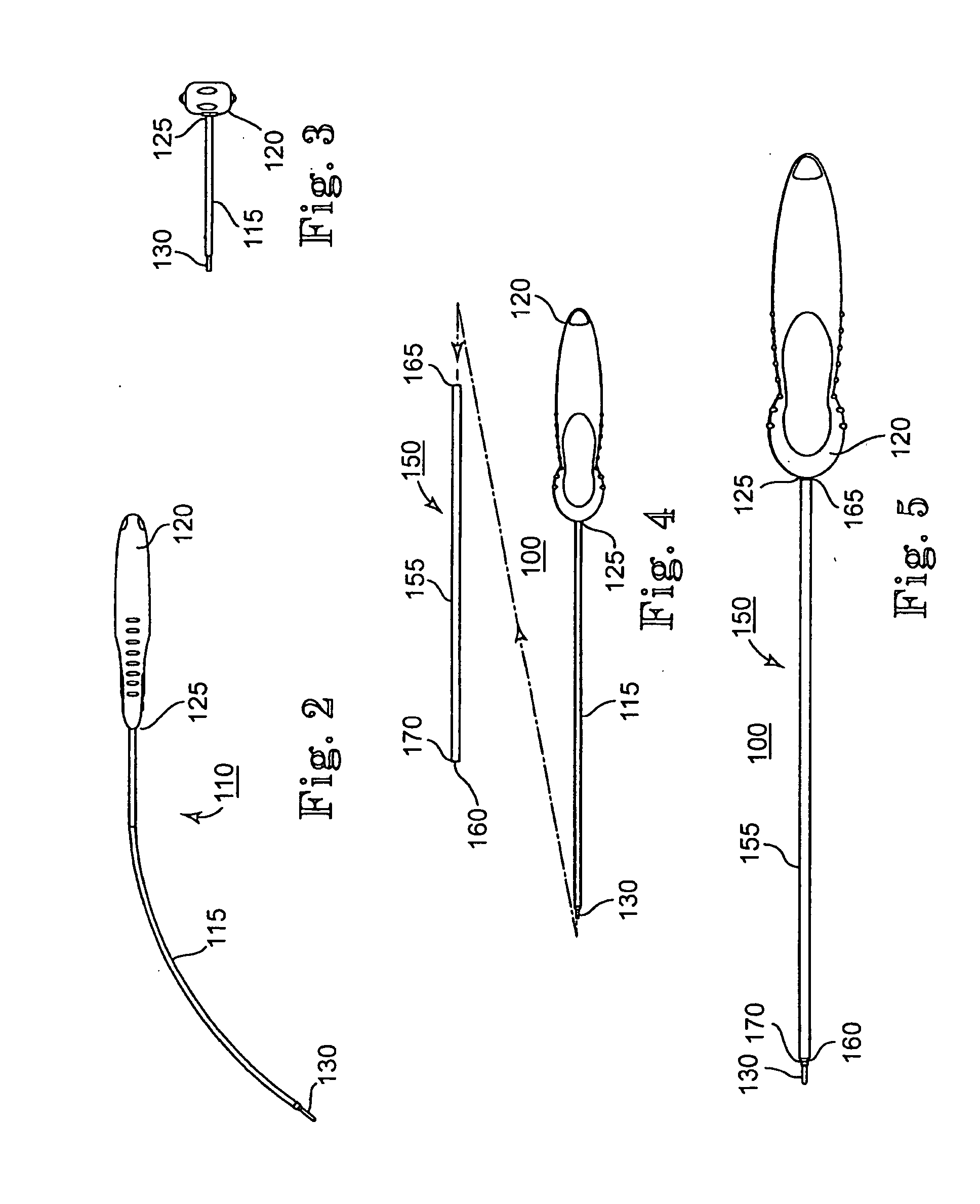 Systems and Methods for Implanting Medical Devices