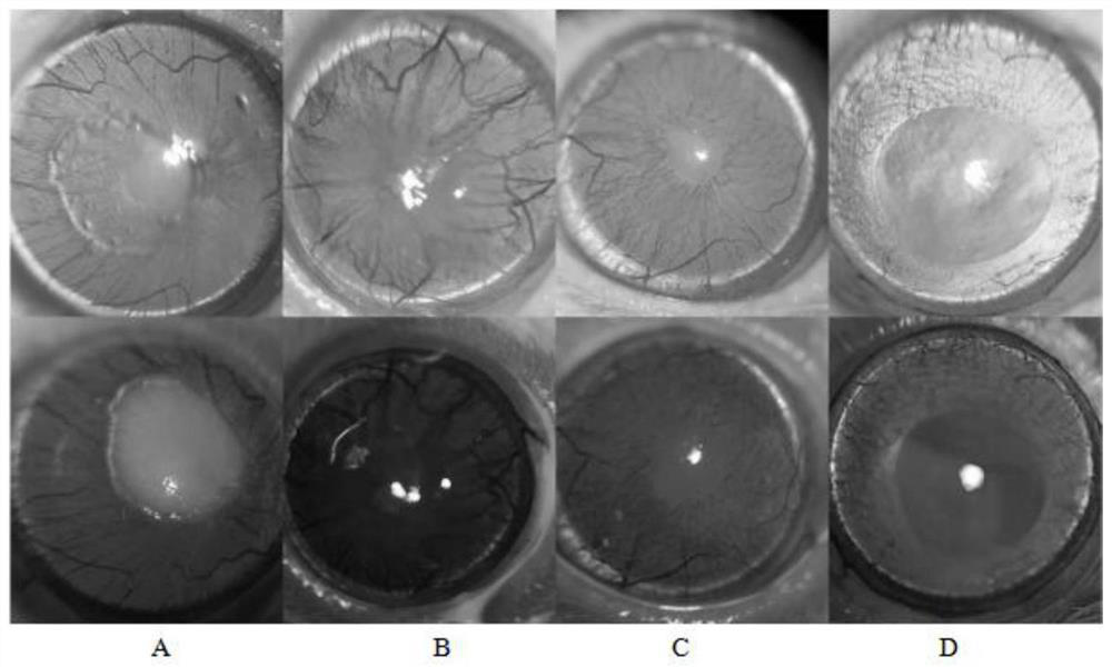 Pharmaceutical composition for corneal tissue repair of insulin nano system and application of pharmaceutical composition