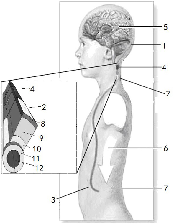 System and method for detecting cerebrospinal fluid shunt flow