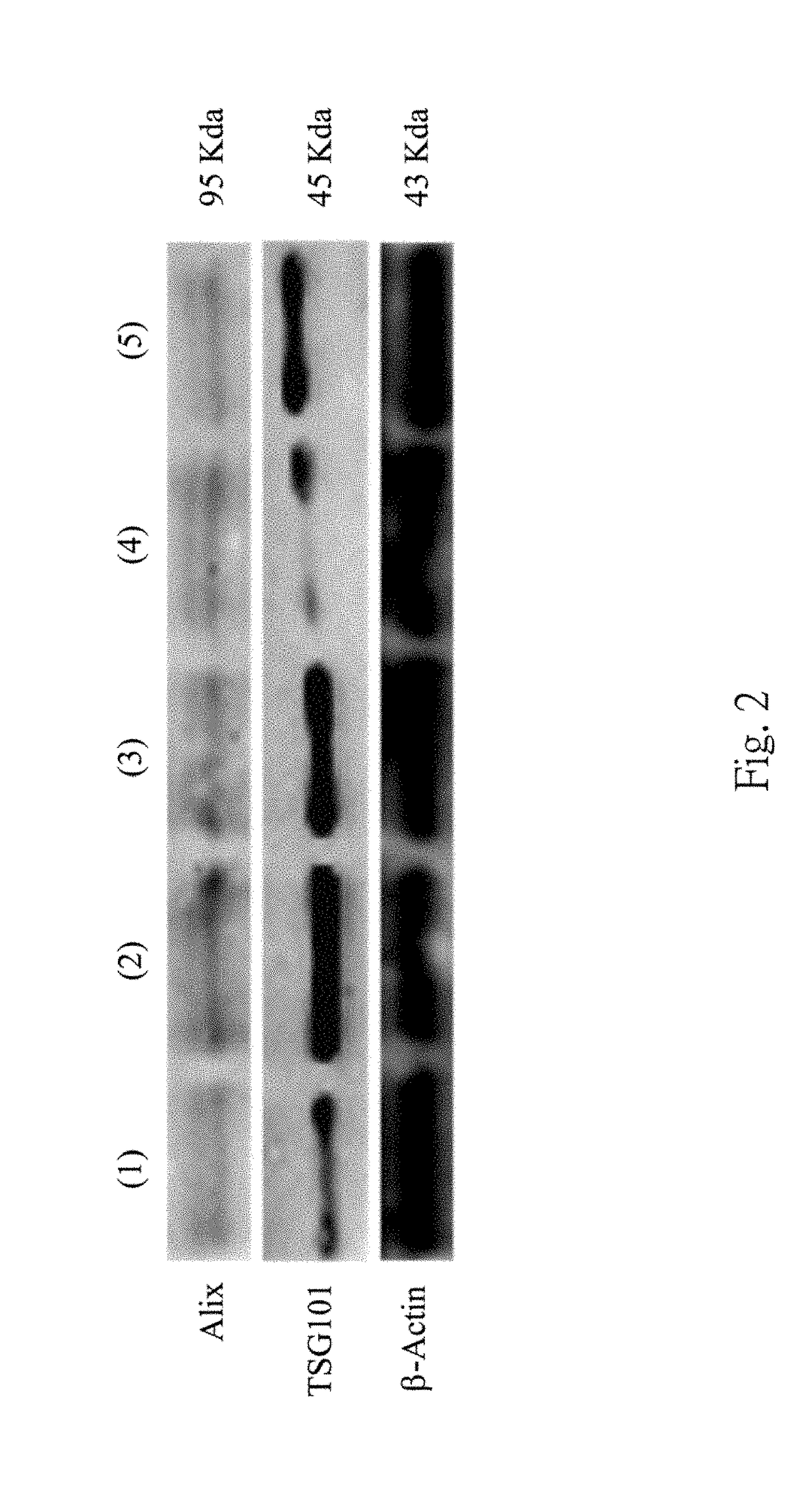Method for validating existence of urinary exosome, non-invasive method for identifying urothelial cancer, and method for predicting recurrence and progression of urothelial cancer patient after treatment