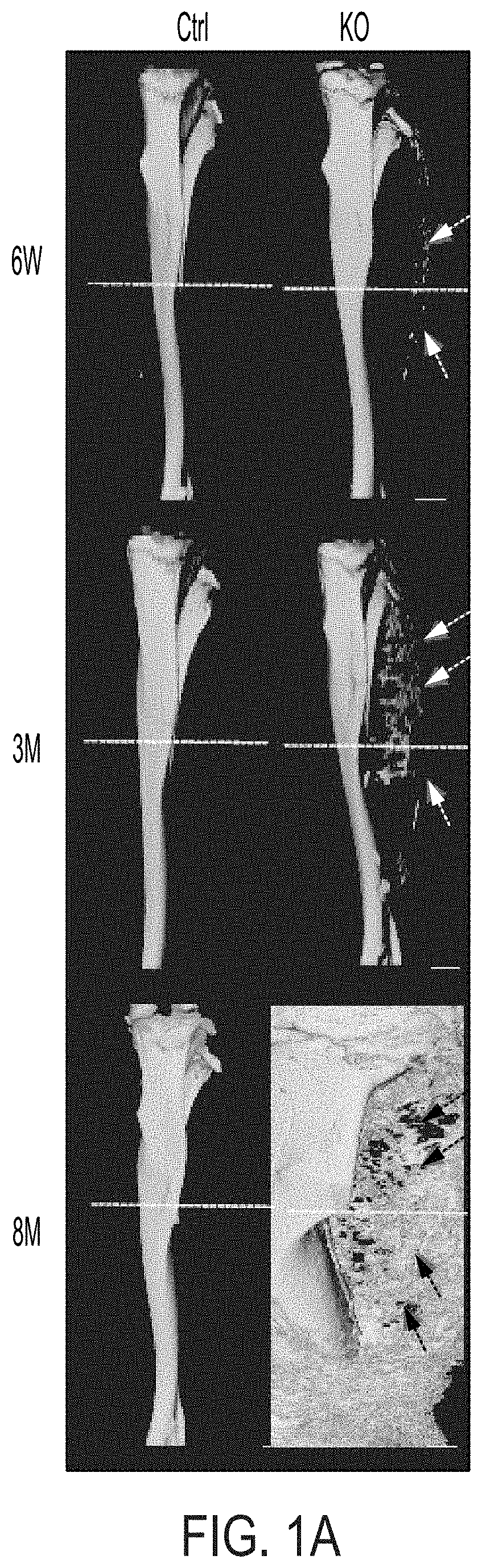 Methods and compositions for treating heterotopic ossification