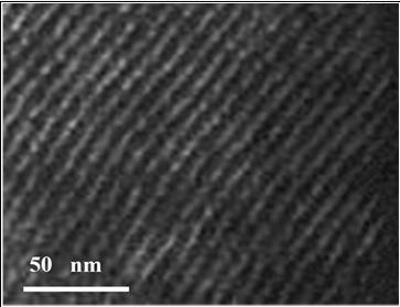 Preparation method of degradation acidity-adjustable self-enhanced polyester/ordered mesoporous degradable bone repair material as well as product and application thereof