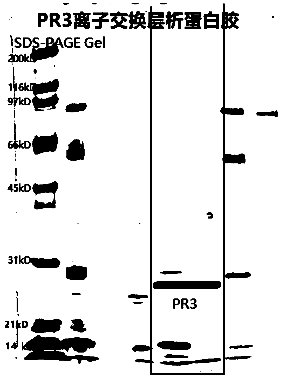 Method for separating and purifying natural protease 3 from azurophilic granules of human blood neutrophile granulocytes