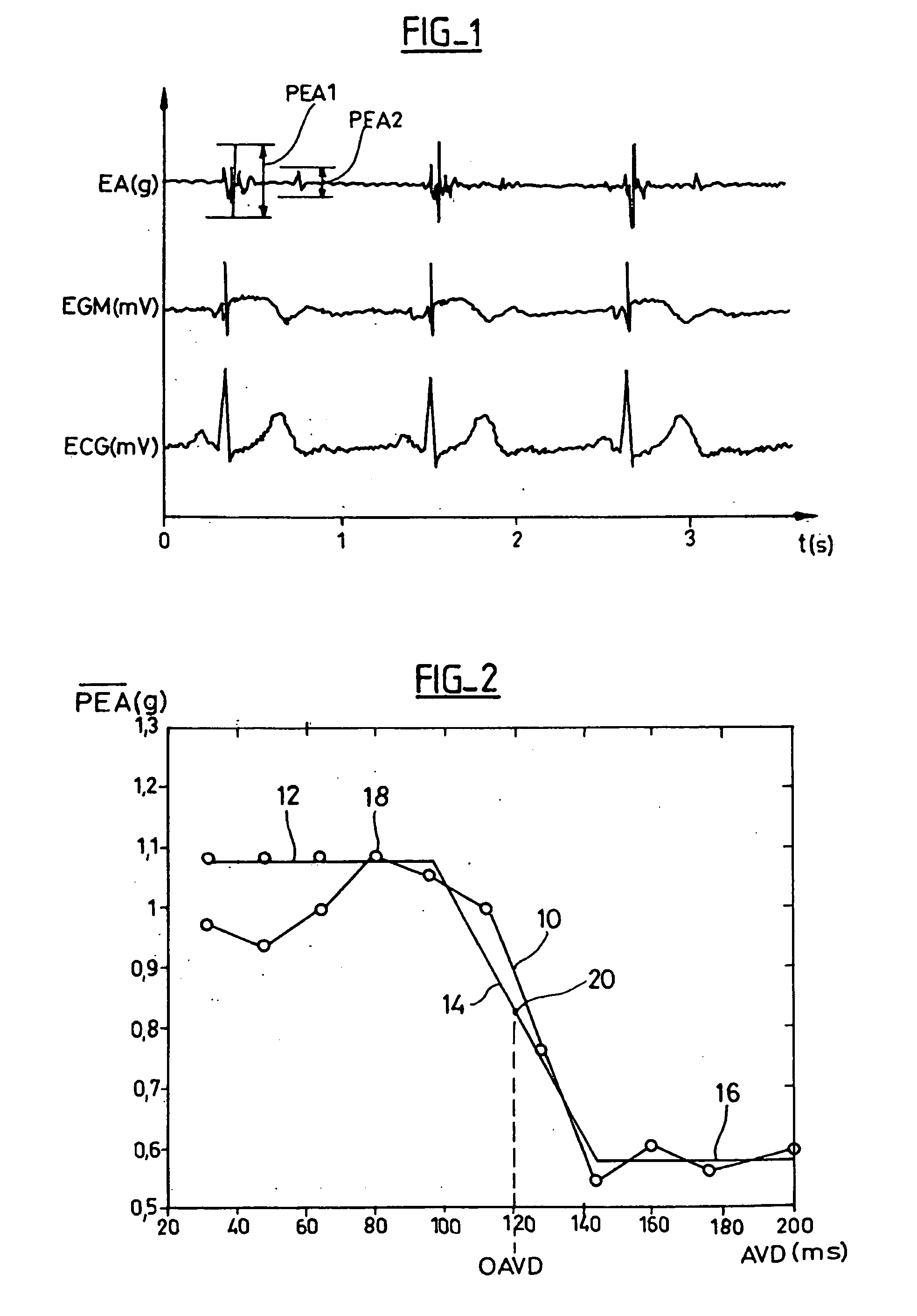 Device For Characterizing the Cardiac Status Of A Patient Equipped With A Biventricular Pacing Active Implant