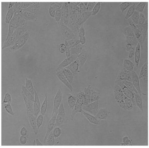 Tumor cell apoptotic bodies induced by CO2 shock method and anti-tumor application of tumor cell apoptotic bodies