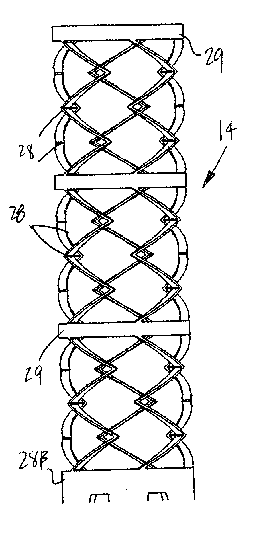 Device for soft tissue support and method for anchoring