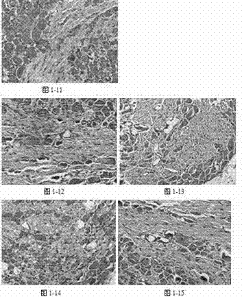 Application of hydrogen physiological saline in preparation for medicine treating acute neurological damage diseases