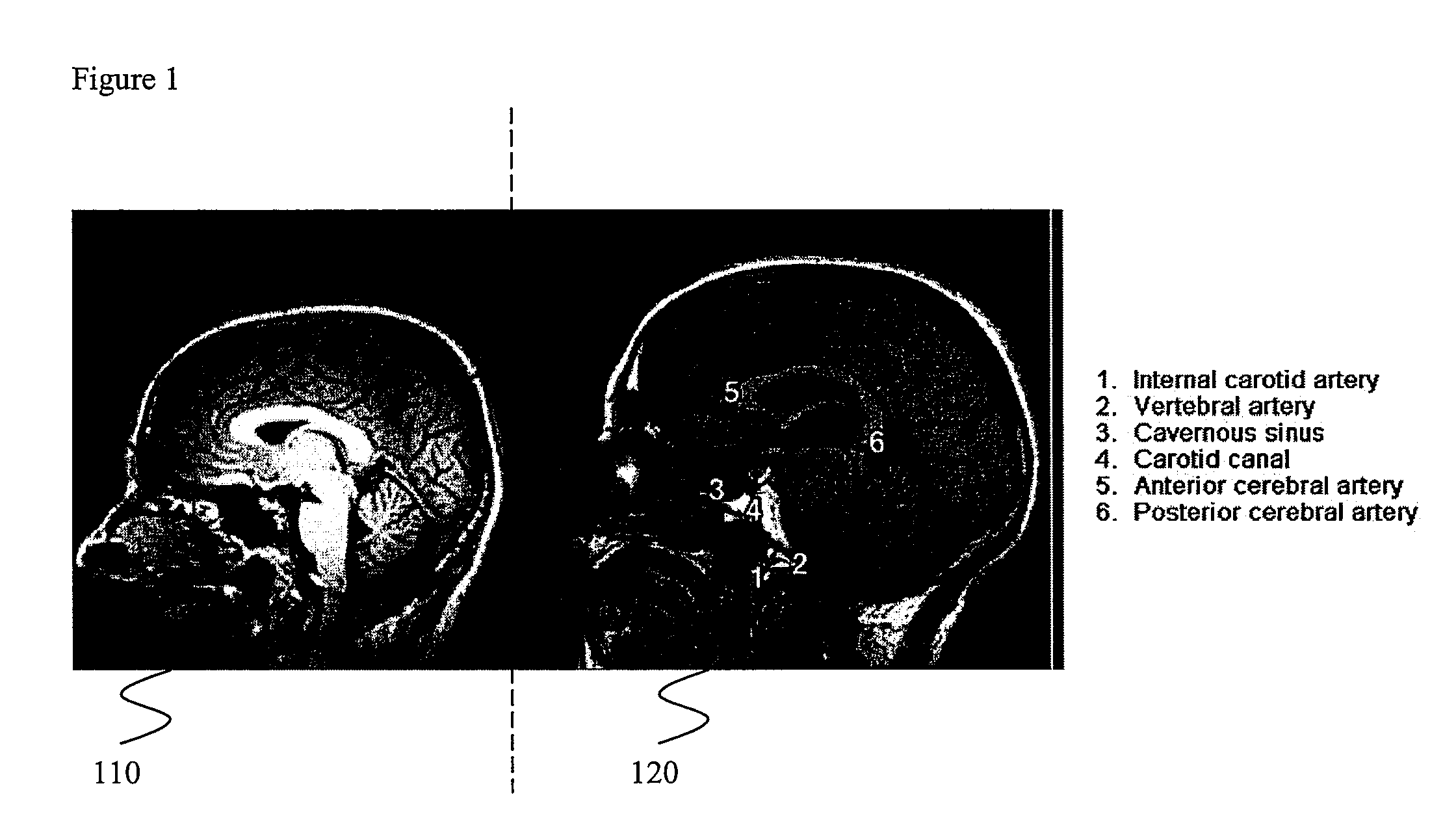 Systems and Methods for Synchronized Image Viewing With an Image Atlas