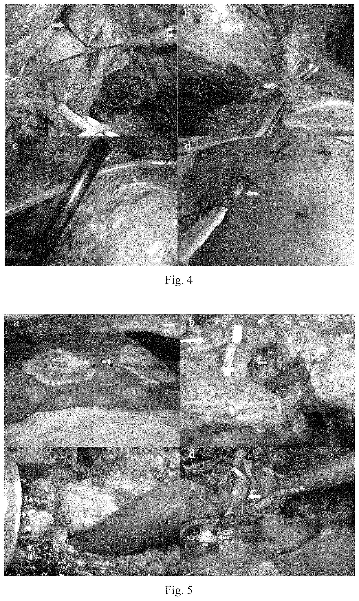 Completely laparoscopic staged hepatectomy using round-the-liver ligation and its instrument