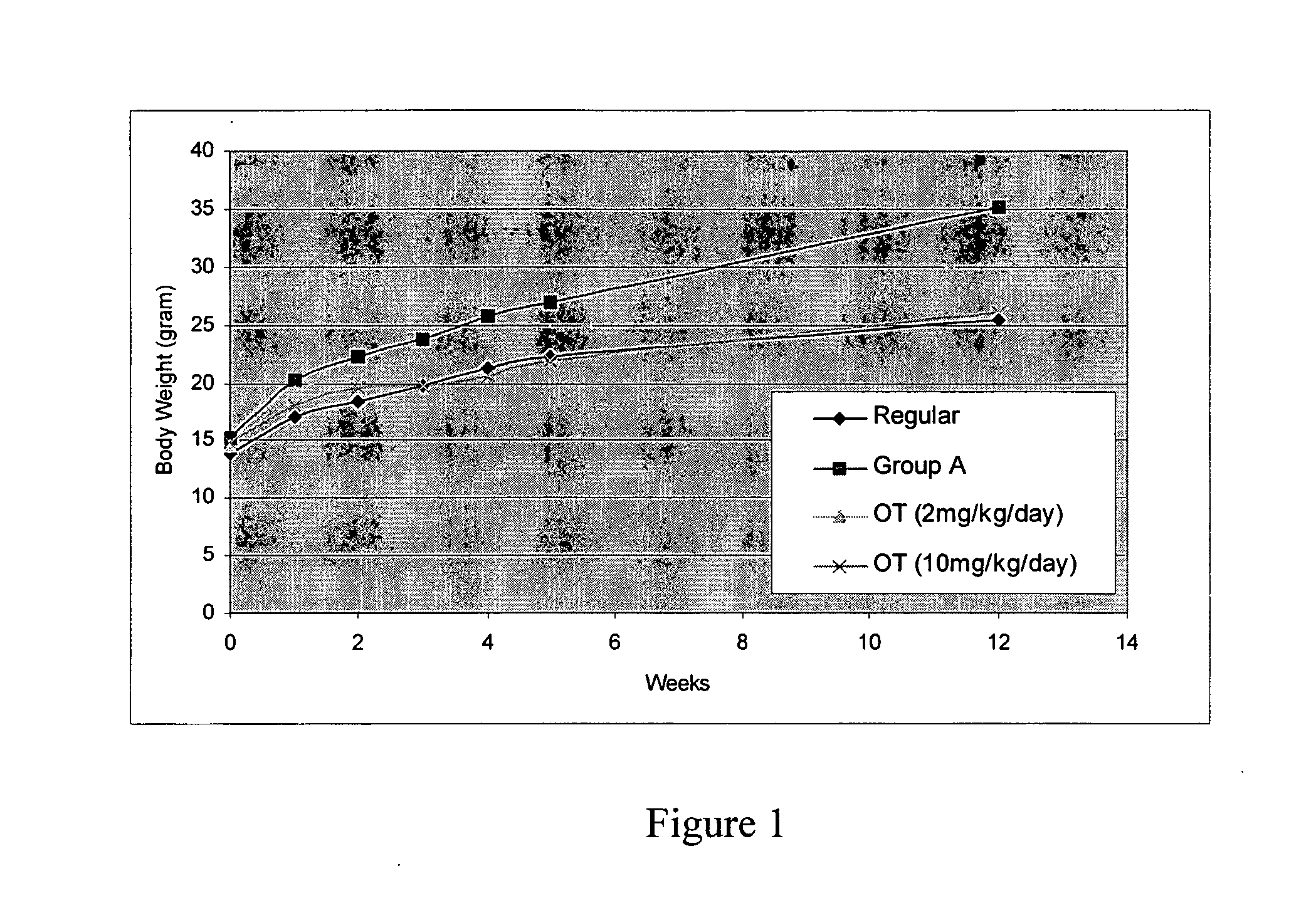 Method for preventing or treating obesity by modulating the activities of the pentose phosphate patway