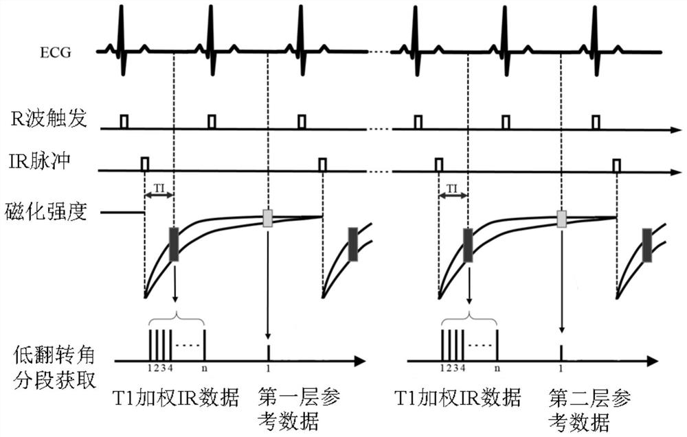 Magnetic resonance imaging method and system