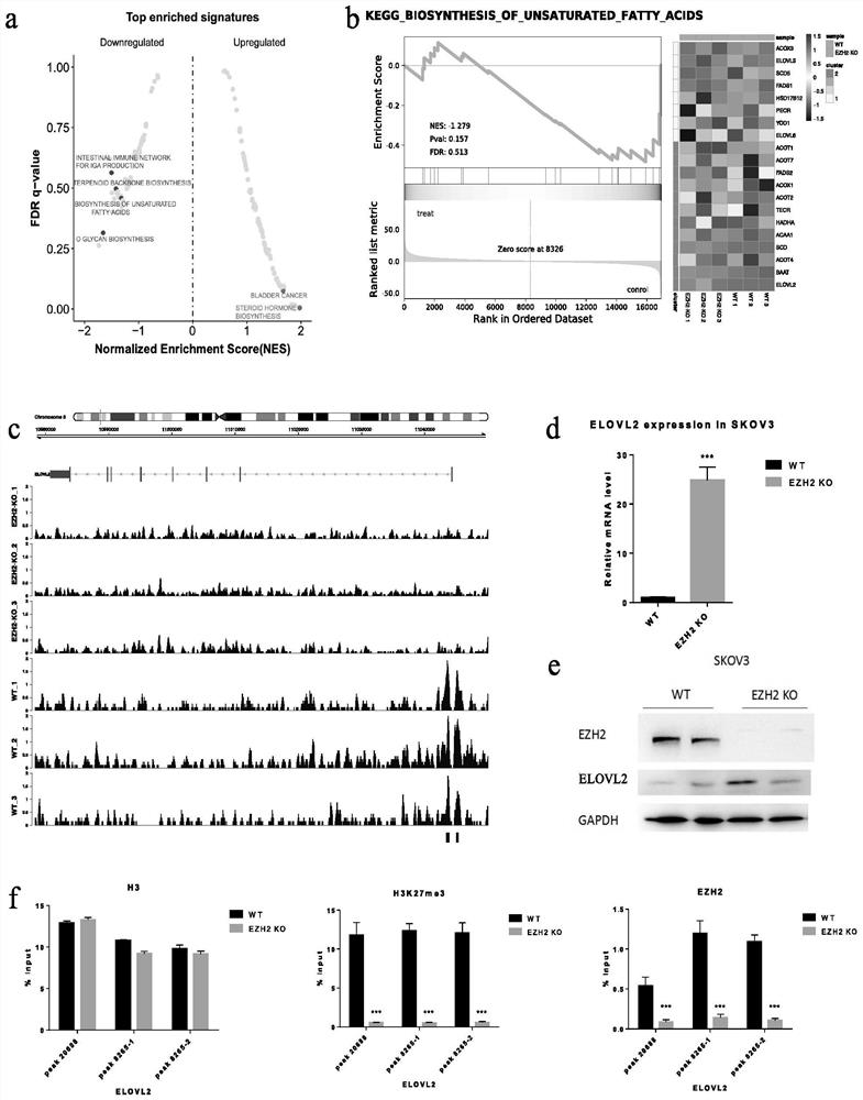 Anti-tumor pharmaceutical composition containing EZH2 inhibitor and polyunsaturated fatty acid inhibitor and application of anti-tumor pharmaceutical composition