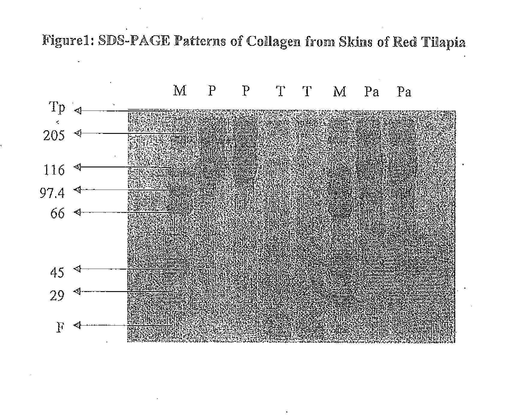 Collagen extraction from aquatic animals