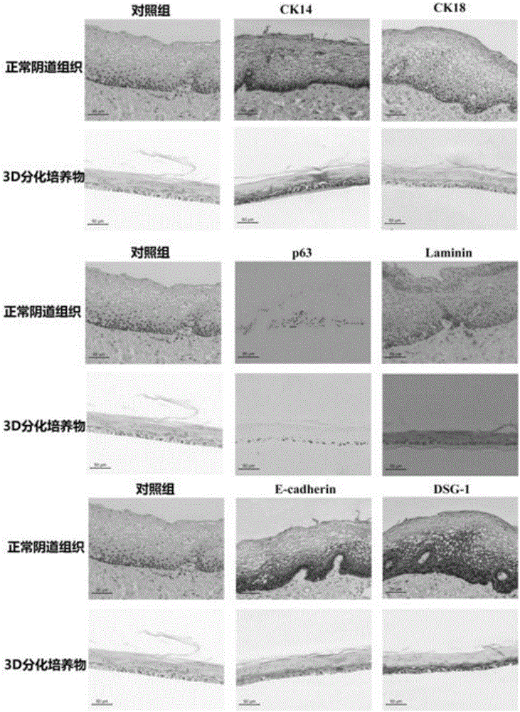 Construction method and application of human normal vaginal epithelium 3D (Three Dimensional) differentiation culture model