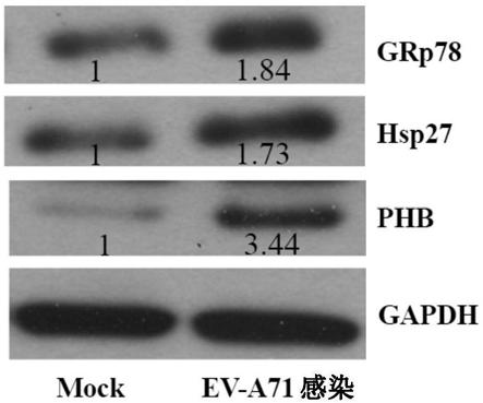 Method for targeting Hsp27 to inhibit enterovirus type A71 infection and related applications