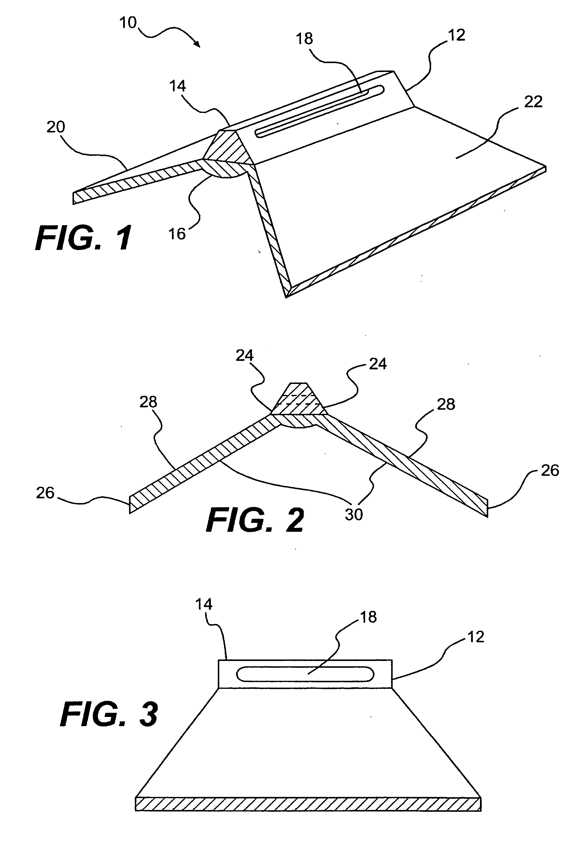 Spinal disc annulus reconstruction method and deformable spinal disc annulus stent