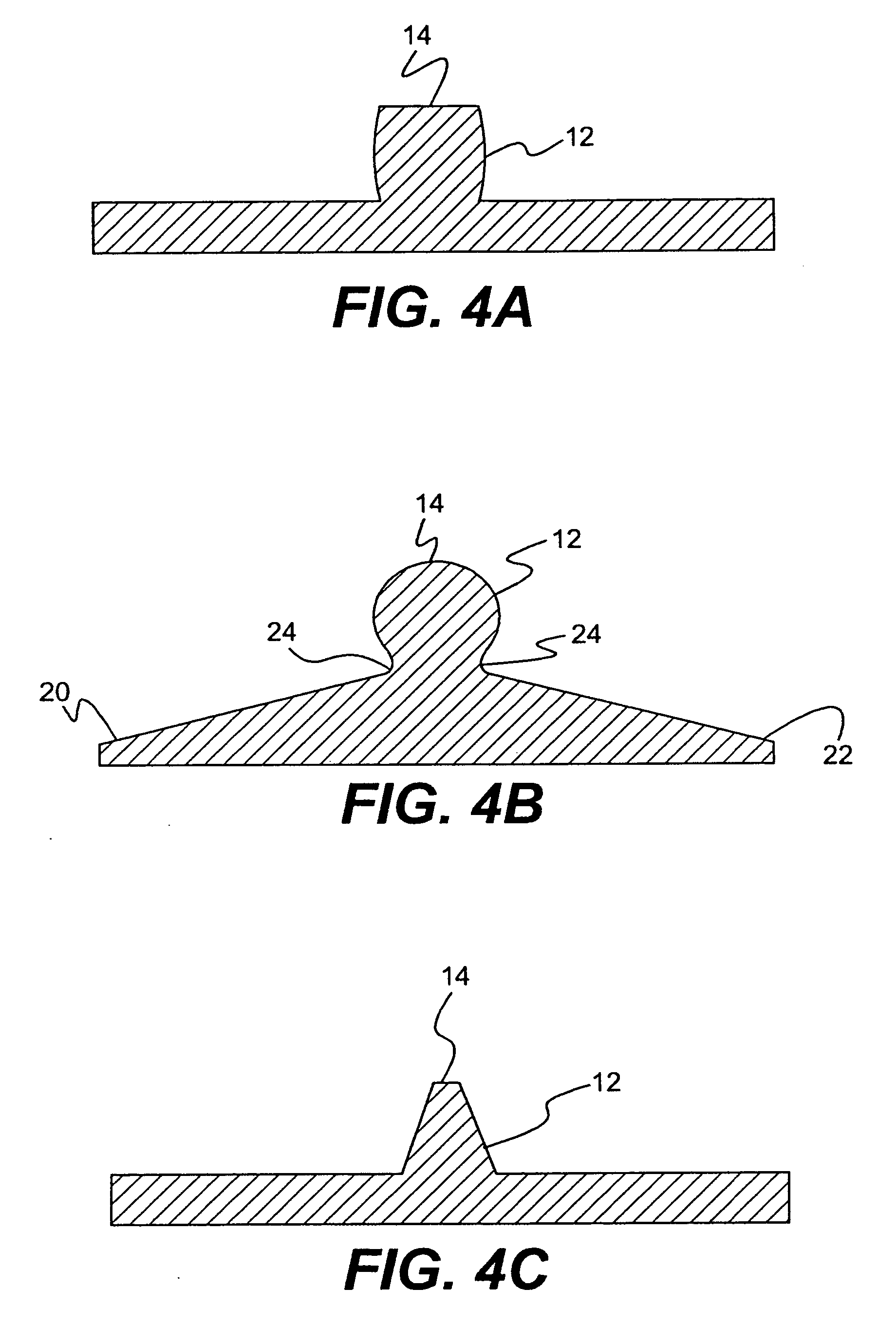Spinal disc annulus reconstruction method and deformable spinal disc annulus stent