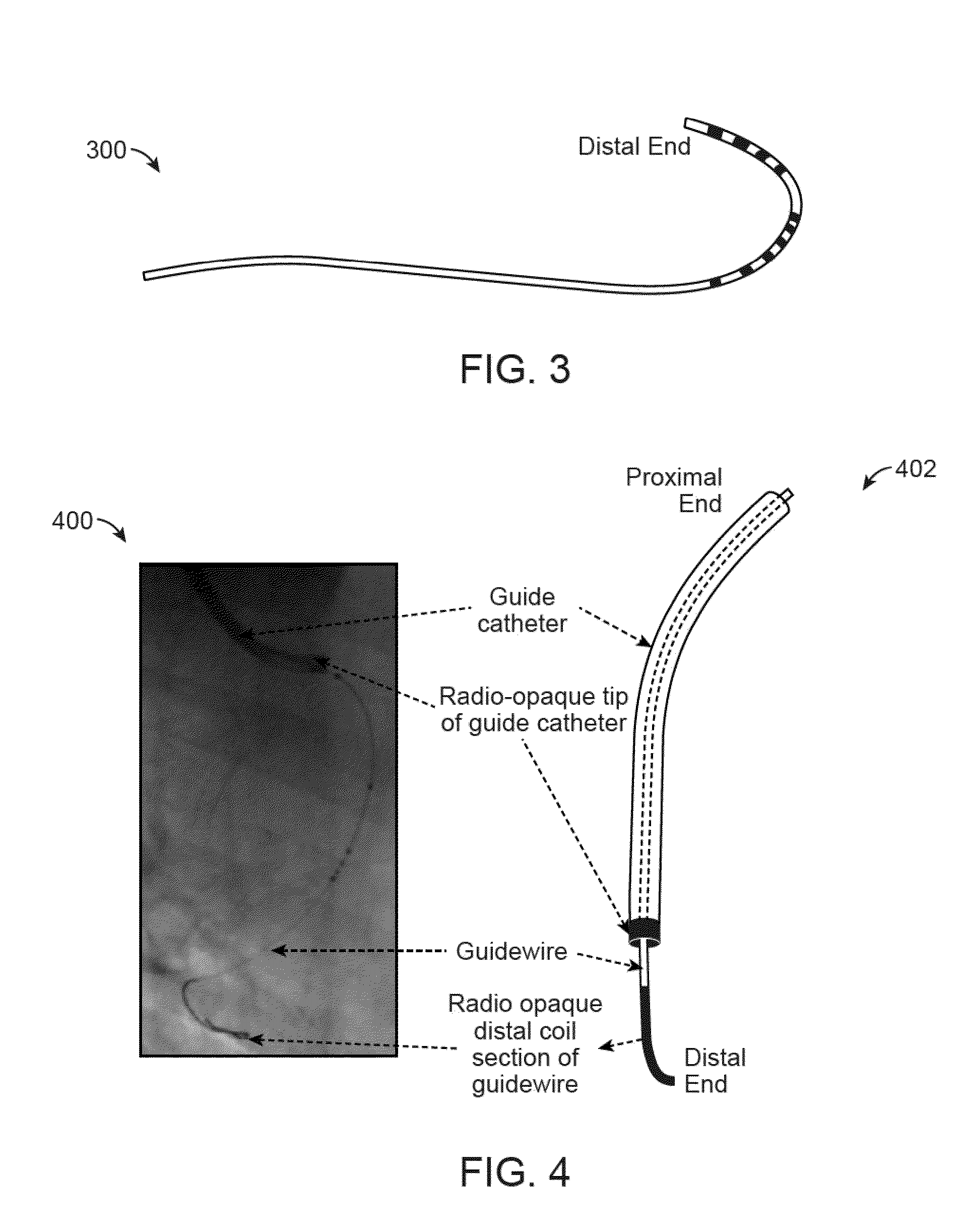 Systems for detecting and tracking of objects and co-registration