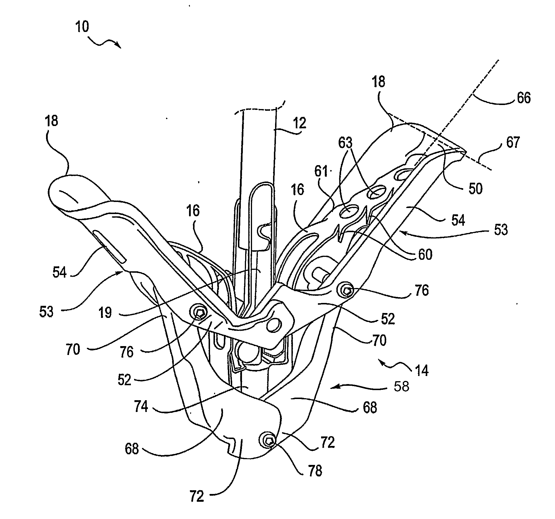 Mitral valve fixation device removal devices and methods