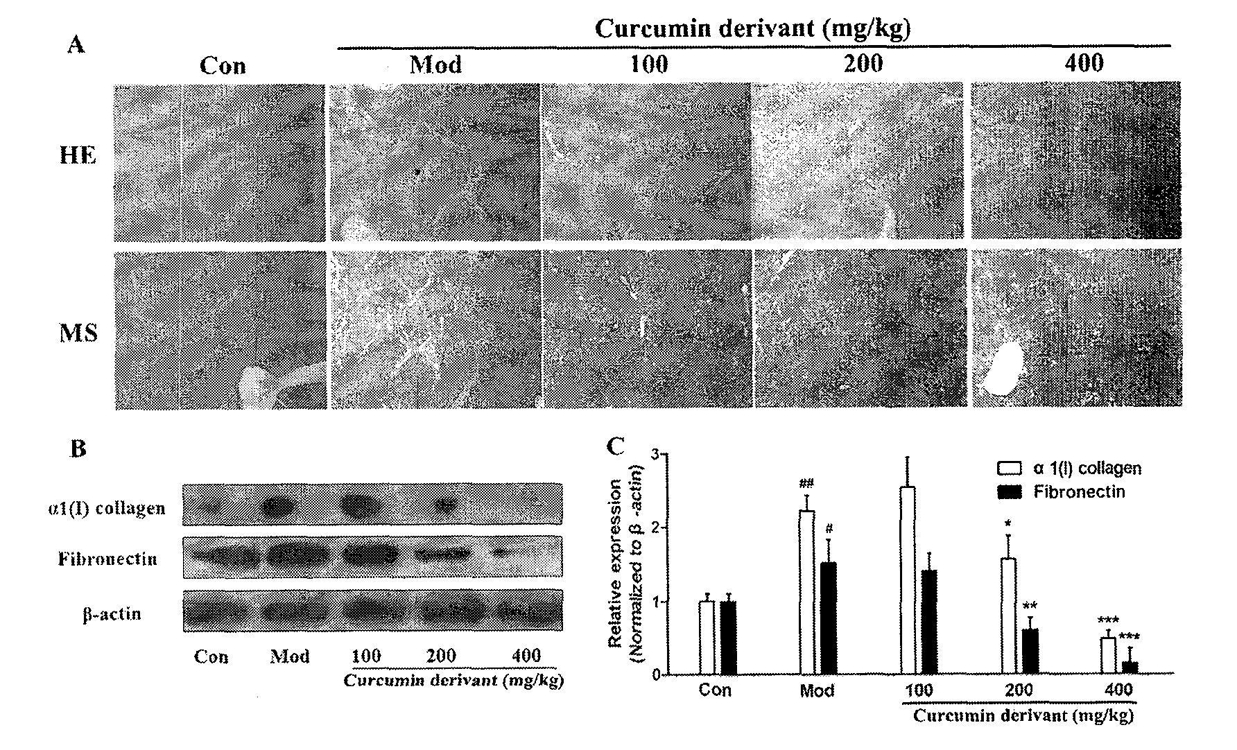 Curcumin derivative and application of curcumin derivative as cannabinoid receptor modulator