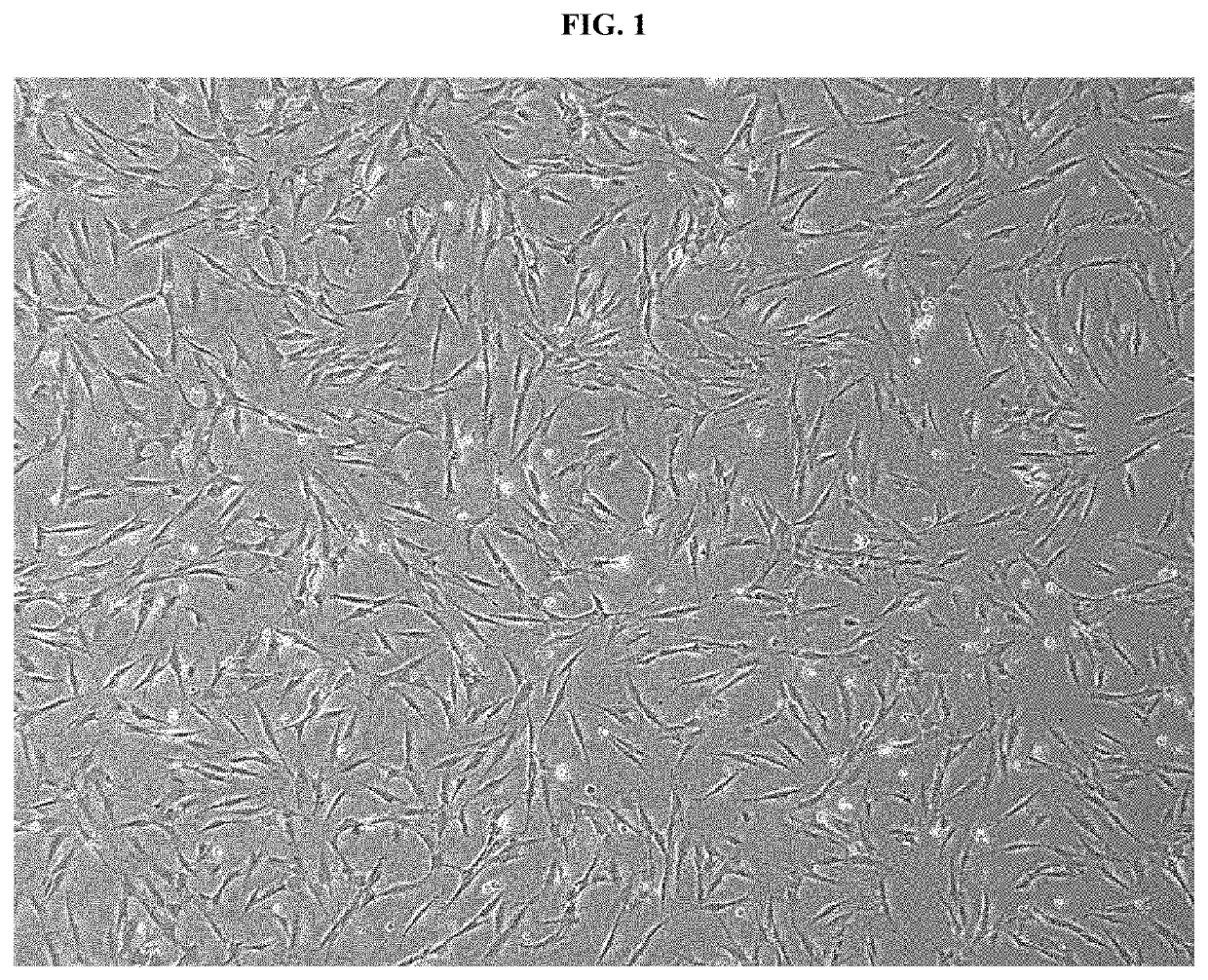 Pharmaceutical composition for preventing or treating rheumatoid arthritis comprising nasal inferior turbinate-derived mesenchymal stem cells as an active ingredient