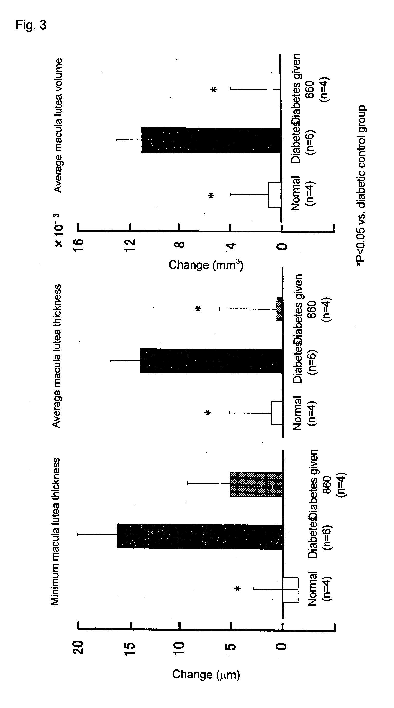 Prophylactic or Therapeutic Agent for Diabetic Maculopathy