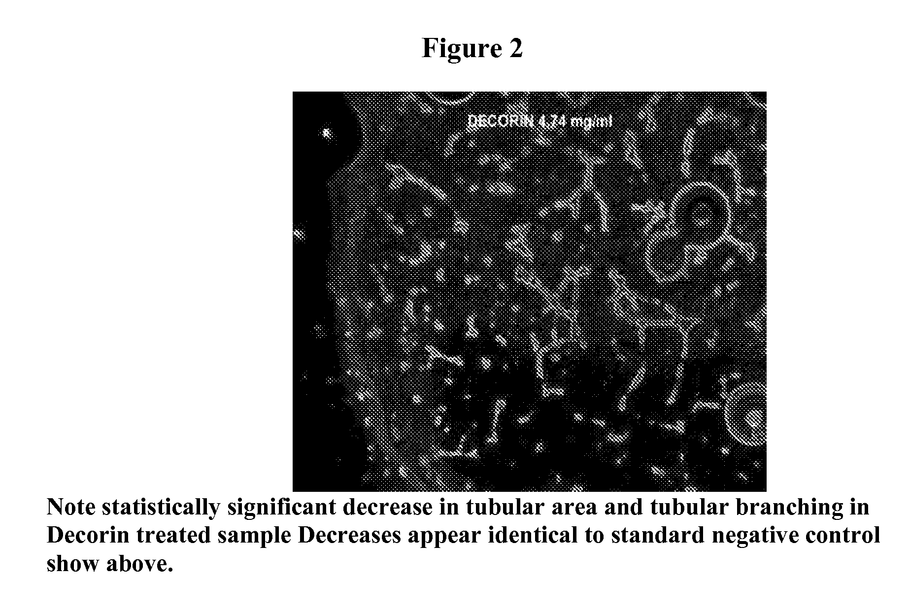 Composition and methods for the prevention and treatment of macular degeneration, diabetic retinopathy, and diabetic macular edema