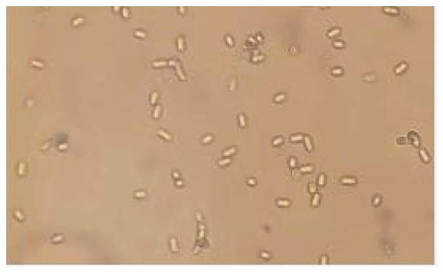 Locust microsporidia AL200801 strain as well as biological preparation and application thereof